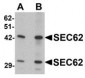 SEC62 Antibody