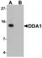 DDA Antibody