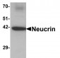 NEUCRIN Antibody