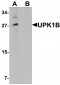 UPK1B Antibody