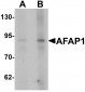 AFAP1 Antibody