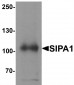 SIPA1 Antibody