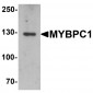 MYBPC1 Antibody