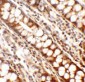 Periphilin Antibody