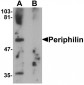 Periphilin Antibody