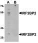 IRF2BP2 Antibody