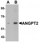 ANGPT2 Antibody