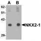 NKX2-1 Antibody