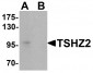 TSHZ2 Antibody