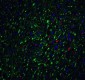 SIGLEC15 Antibody