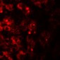 TMEM106B Antibody