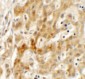 TMEM106B Antibody