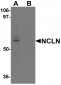 NCLN Antibody