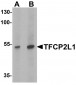 TFCP2L1 Antibody