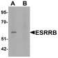 ESRRB Antibody