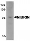 NIBRIN Antibody