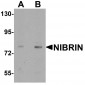 NIBRIN Antibody