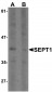 SEPT1 Antibody