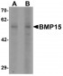 BMP15 Antibody