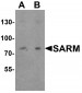 SARM Antibody