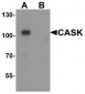 CASK Antibody