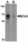 BCL6 Antibody