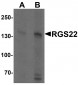 RGS22 Antibody