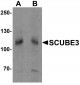 SCUBE3 Antibody