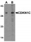 CDKN1C Antibody