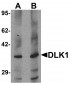DLK1 Antibody