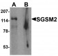 SGSM2 Antibody