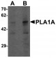 PLA1A Antibody