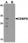 CEBPD Antibody