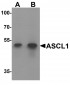 ACSL1 Antibody