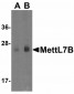 LMX1A Antibody