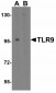 LMX1A Antibody