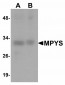 LMX1B Antibody