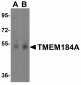 LMX1B Antibody