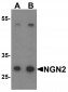 NGN2 Antibody