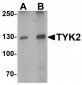 TYK2 Antibody