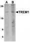 TREM1 Antibody