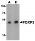 FOXP3 Antibody