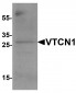 VTCN1 Antibody