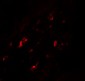 PTGDR2 Antibody