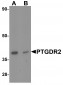 PTGDR2 Antibody