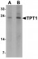 TPT1 Antibody
