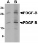 PDGF-B Antibody