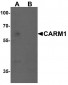 CARM1 Antibody
