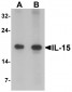 IL-15 Antibody