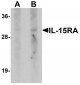 IL-15RA Antibody
